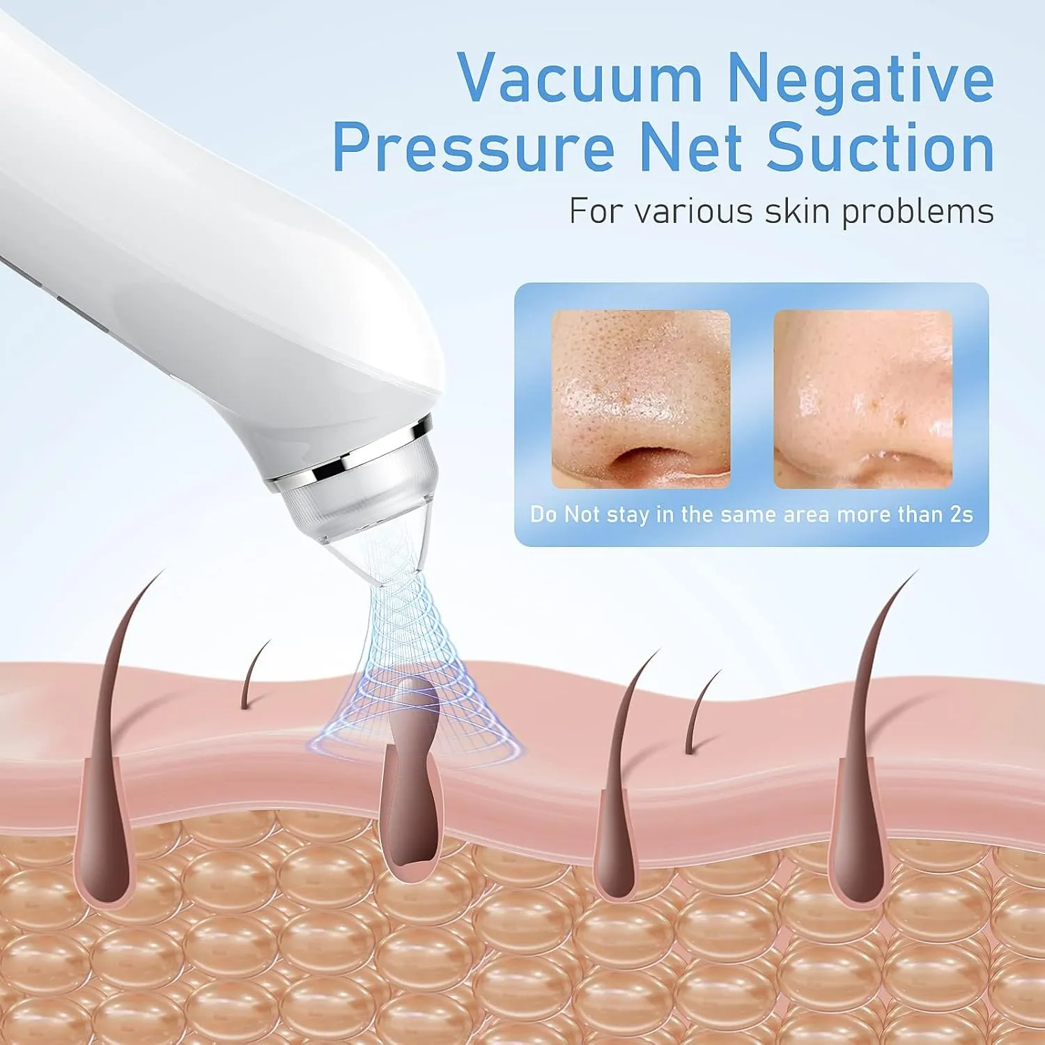 Multi-Functional Blackhead Suction Device - Gentle & Effective Skin Care, 6 Suction Heads & 3 Modes for Deep Pore Cleaning(Black)