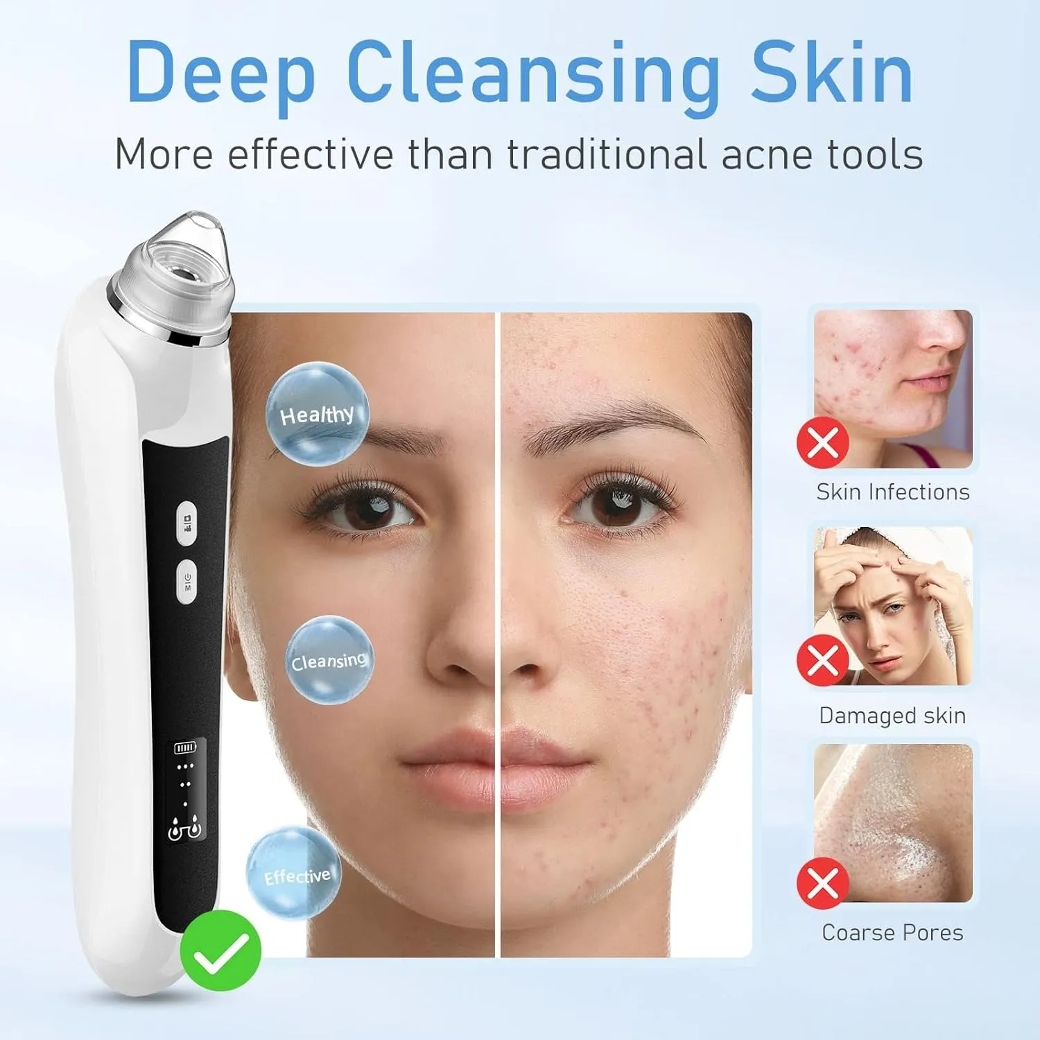 Multi-Functional Blackhead Suction Device - Gentle & Effective Skin Care, 6 Suction Heads & 3 Modes for Deep Pore Cleaning(Black)